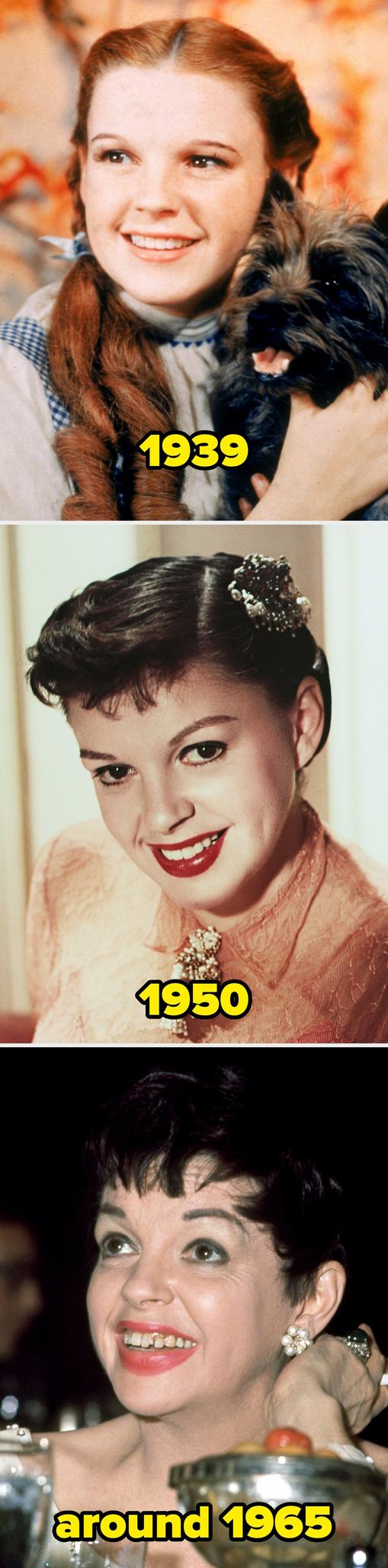 Judy Garland con y sin carillas