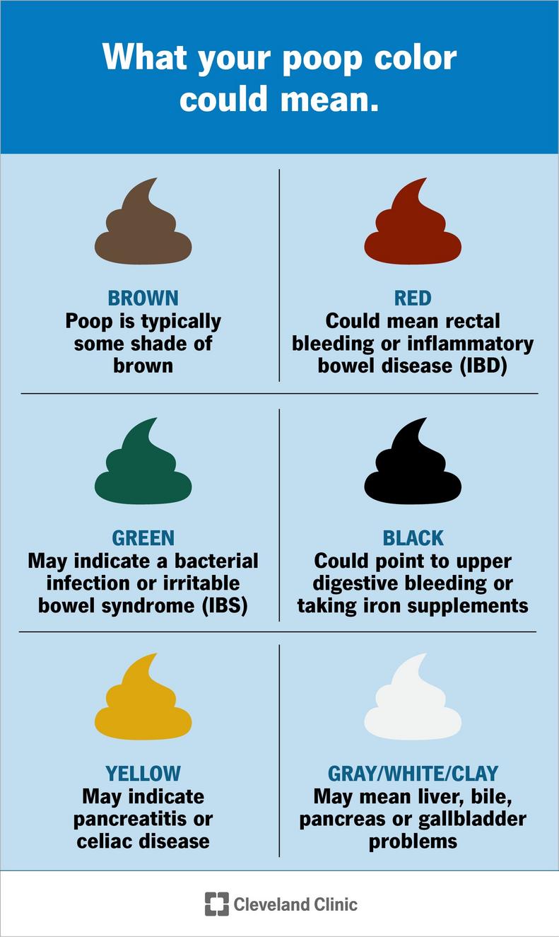 Infografía sobre los colores de las heces