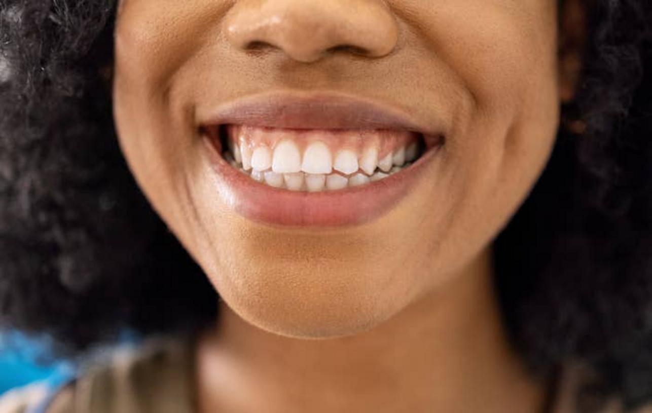 Paciente en el dentista sonriendo