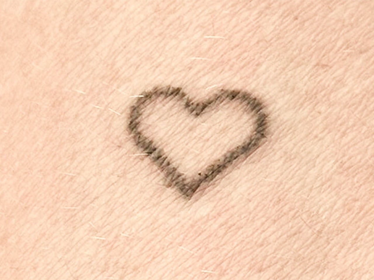 Tatuaje de un corazón en tinta negra sobre la piel, resultado del parche de microagujas pasadas 48 horas